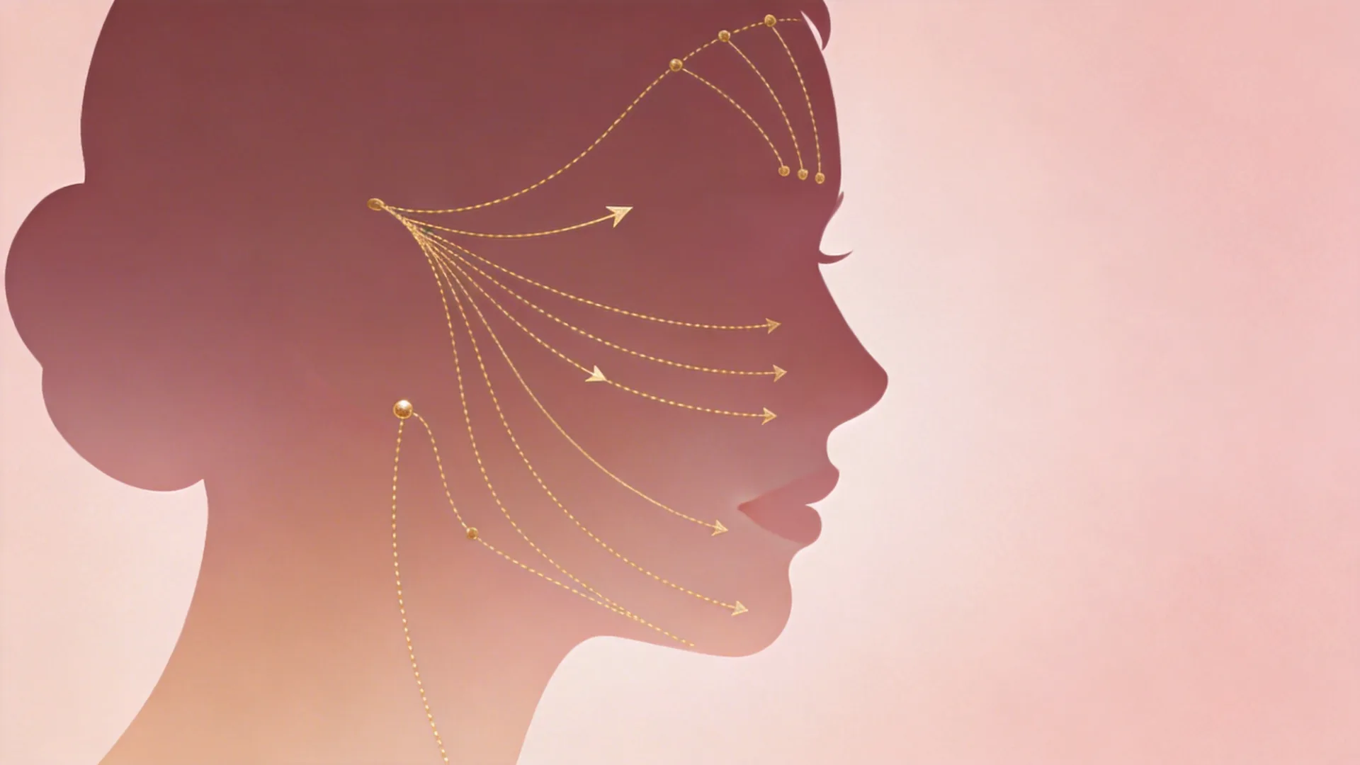 2026埋線拉提新技術突破 鈴鐺線與玫瑰線